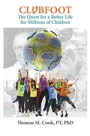 Clubfoot