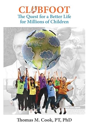 Clubfoot