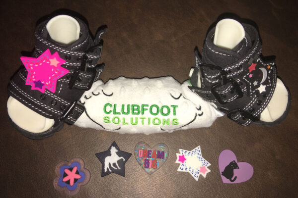 Corrective bracing with baubles | Clubfoot Solutions Shop